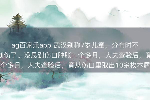 ag百家乐app 武汉别称7岁儿童,分布时不留神摔到花圃里,把脸划伤了。没思到伤口肿胀一个多月,大夫查验后,竟从伤口里取出10余枚木屑
